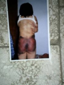 图：潍坊警察把大法弟子的妻子（常人）绑架、毒打后的照片。
