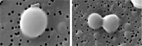 Primo经络管的超微型细胞“活卵（左图）”在分裂的过程（右图）。“活卵”具有其它细胞没有的完全不一样的细胞特性。
