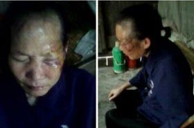 '谭翠英遭国保警察暴打后的照片，老人双目紧闭，伤痕累累。'