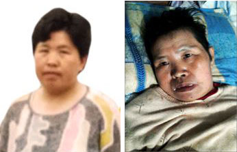 '张素华被迫害前与被迫害瘫痪在床去世不久前照片'