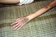 照片是蒋美兰被营救回家后，第二天拍的，蒋美兰全身瘦的只剩皮包骨，她的手臂青紫都是打点滴打的。